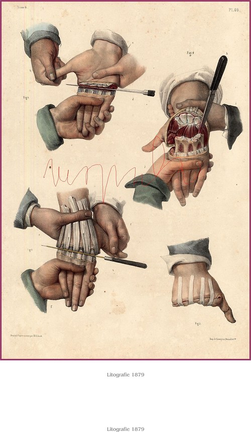 Chirurgie I