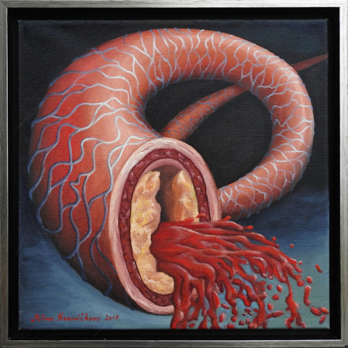 Cholesterol — foto 1