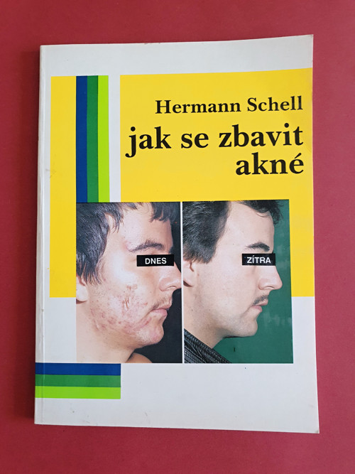 Akné — foto 1