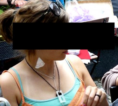 Prsteny na krk — foto 6