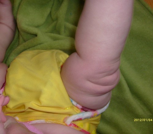 Svrchňáčky žluté :-) — foto 5