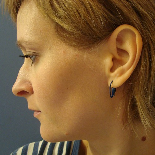 Malé zamotance — foto 2