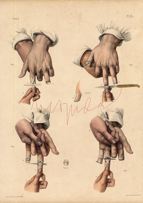 Chirurgie I — foto 2