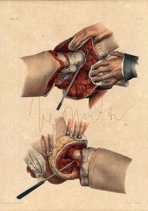 Chirurgie I — foto 3