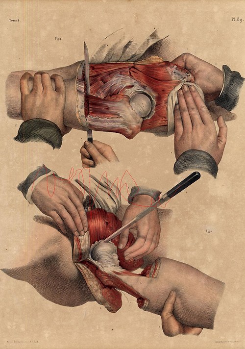 Chirurgie I — foto 4