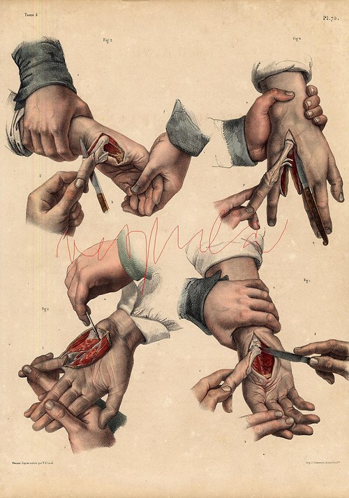 Chirurgie I — foto 5