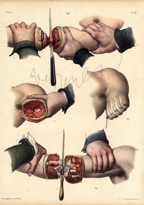 Chirurgie I — foto 6