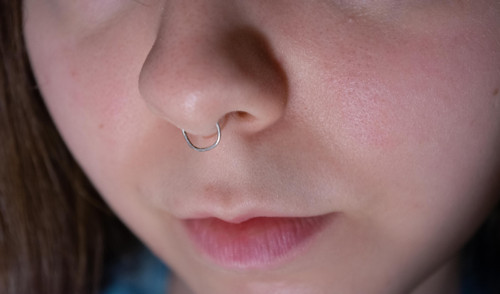 Basic septum — foto 2