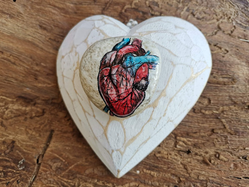 Transplantace srdce — foto 4