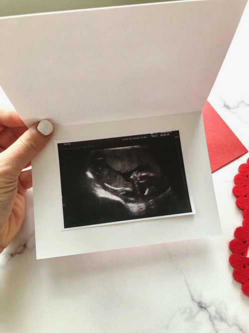 Otevírací přání s ultrazvukem "Překvapení" — foto 2