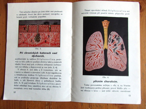 Slabé plíce — foto 4