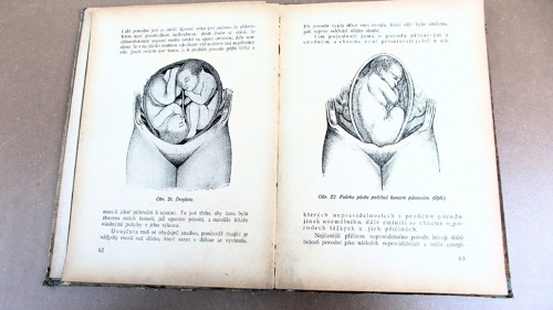 Mladá matka — foto 5