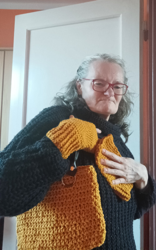 Hořčice na rukou — foto 3